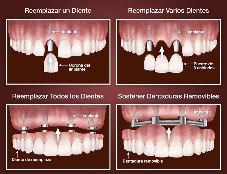 Imagen Galería 0